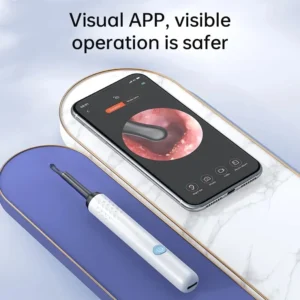WIFI-Visual-Ear-Cleaner-Otoscope-Camera-with-6-LED-Lights-4-0mm-Mini-Ear-Wax-Removal-1.webp